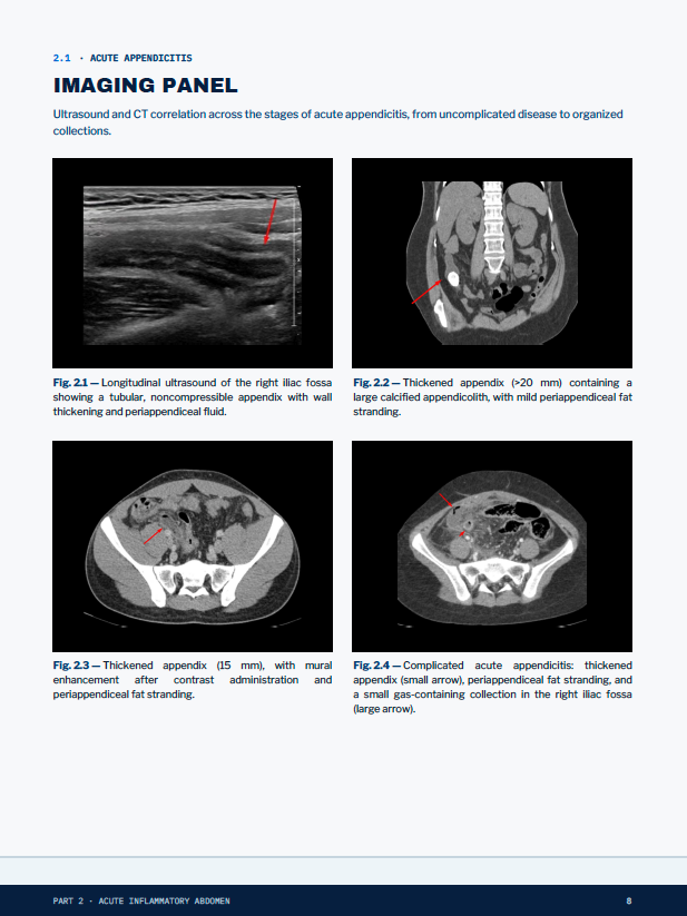 Protected sample of the Acute Appendicitis imaging panel