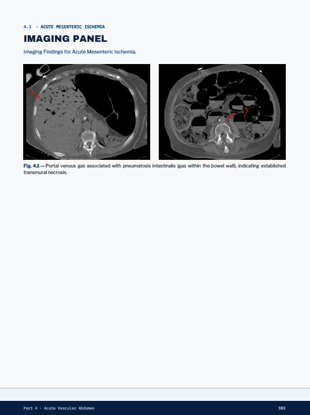 Protected sample of the Acute Mesenteric Ischemia imaging panel
