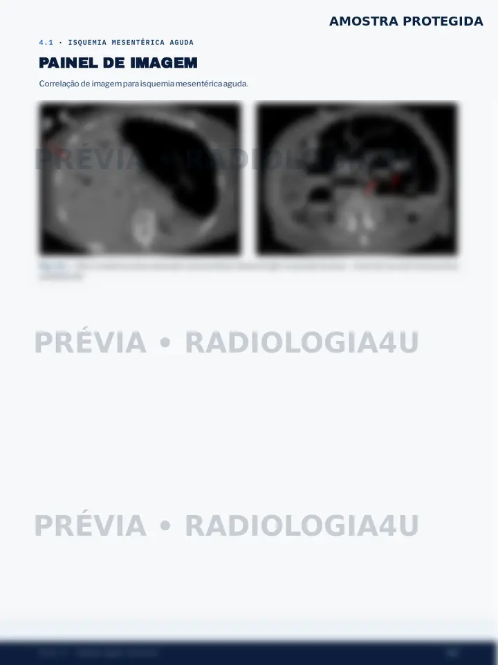 Prévia protegida do painel de imagens de isquemia mesentérica aguda